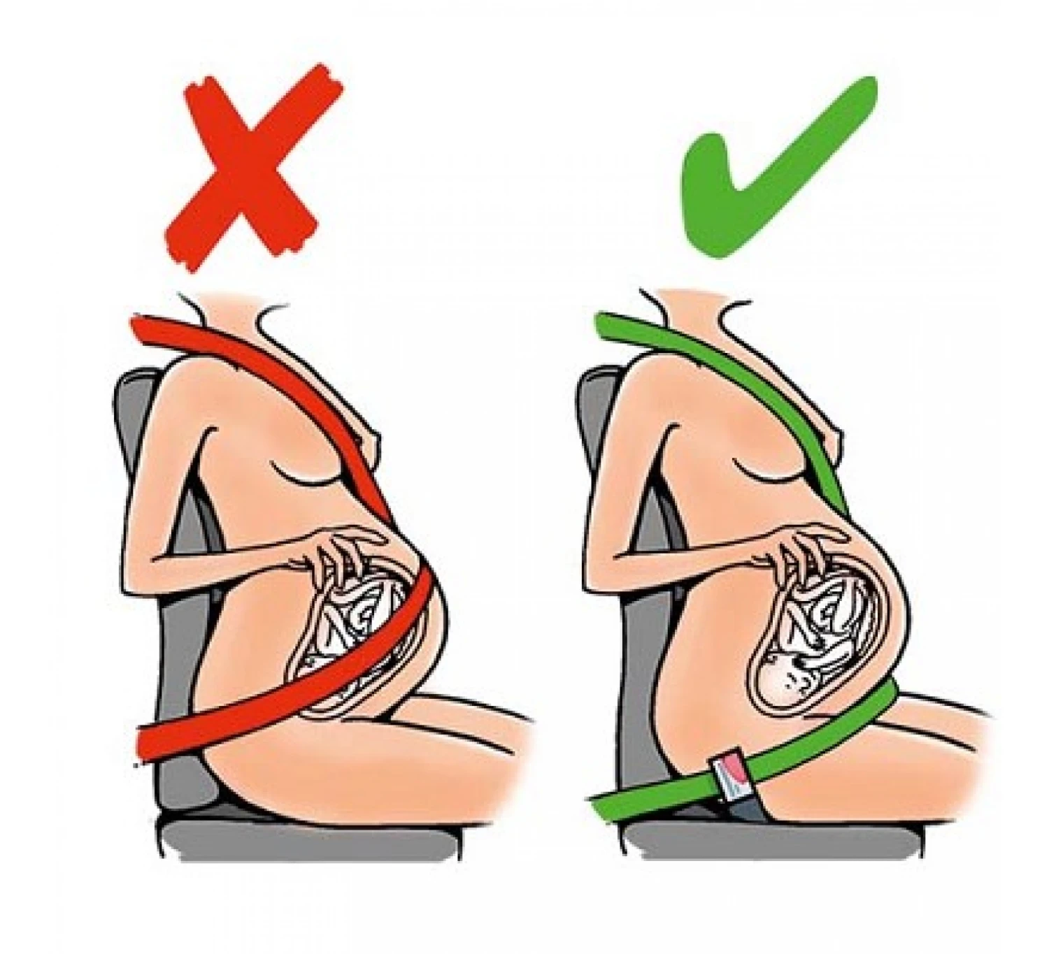 Gordelgeleider Voor Zwangeren 1 Gordelgeleider Voor Zwangeren